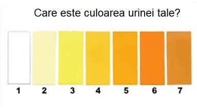 8 tipuri de urină care indică starea de sănătate